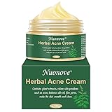 Akne Creme, Anti Pickel Creme, Akne Entferner Creme, Akne Narben Creme, Anti Akne Creme, Balance Wasser und Öl, Hilft Gesicht Akne zu entfernen, Pickel Anti Akne Creme regeneriert die Haut, 100g