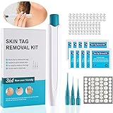 Skin Tag Remover, Stielwarzen Entferner Schnell Kit, Skin Tag Entferner Kit für Micro Bis Large (2 mm-10 mm), Sicher und Schmerzlos, Stielwarzen Entfernungsgerät Sicher für die Meisten Körperteile